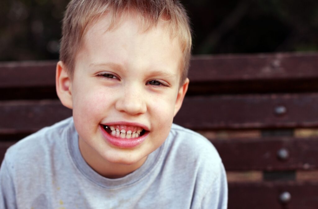 A child with dental crowns smiling.
