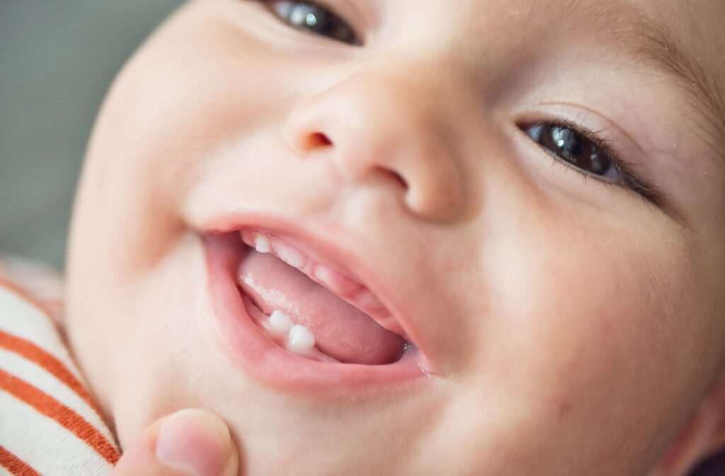 Baby showing his bottom two teeth with three more coming in up top.